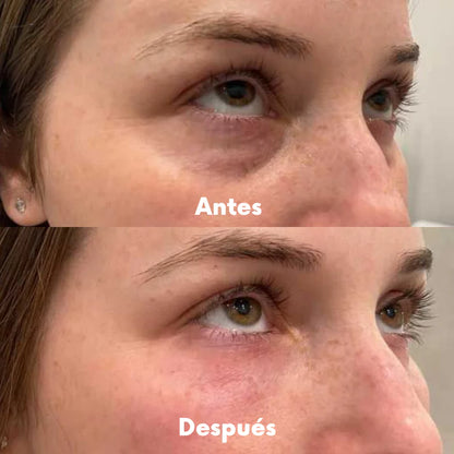 RedVision™ | Gafas de Luz Roja + Sérum Anti Ojeras