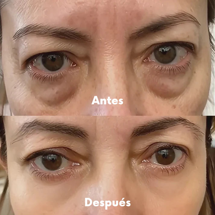 RedVision™ | Gafas de Luz Roja + Sérum Anti Ojeras