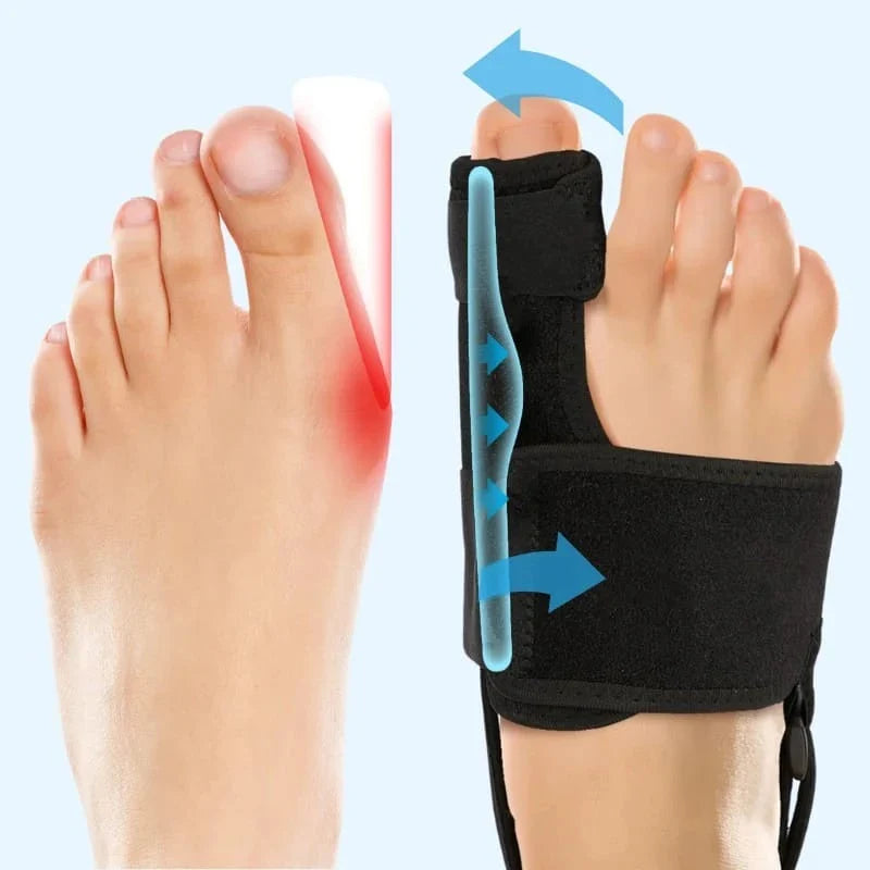 Valgux™ | Corrector Ortopédico Ajustable para Juanetes
