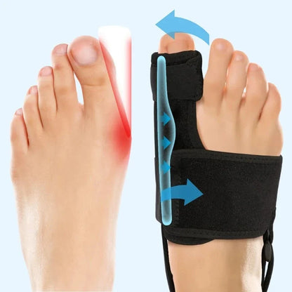 Valgux™ | Corrector Ortopédico Ajustable para Juanetes