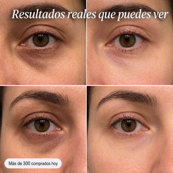 Celimax® Antimanchas y Refinadora de Poros