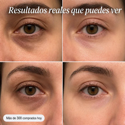 Celimax® Antimanchas y Refinadora de Poros
